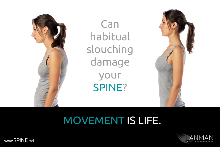 Spine Health: Can bad posture injure your spine?